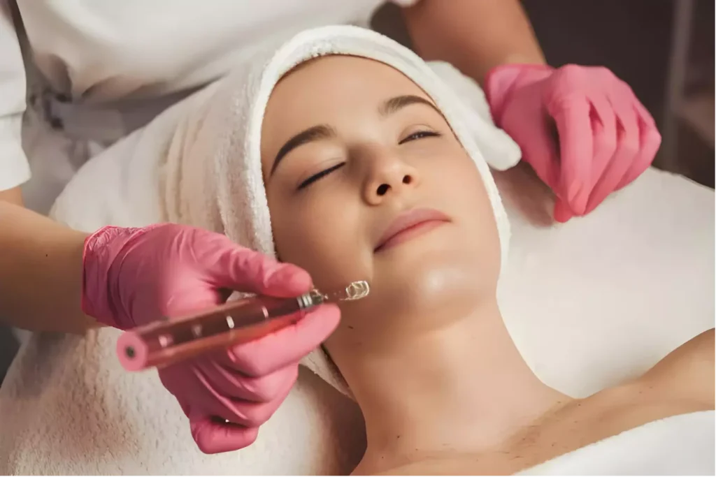 Microneedling in Orlando, FL | Apex Fit