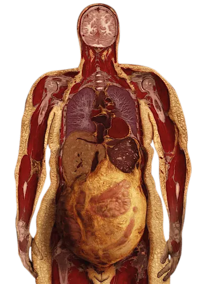 body composition muscle fat