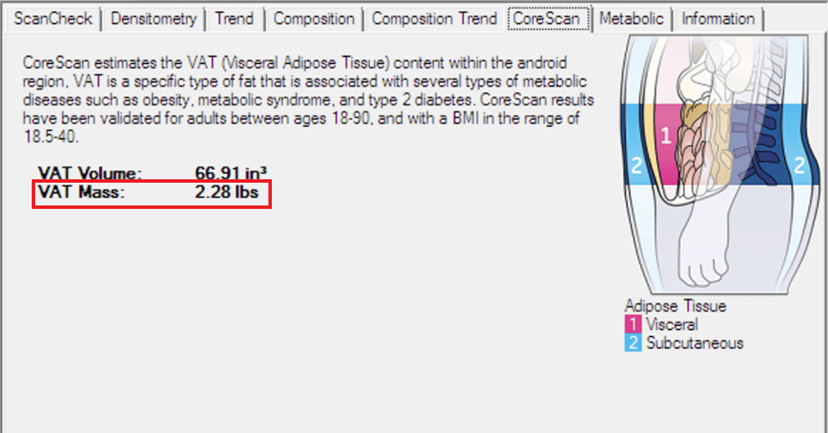 Visceral Fat dexa scan